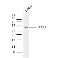 anti-CD90