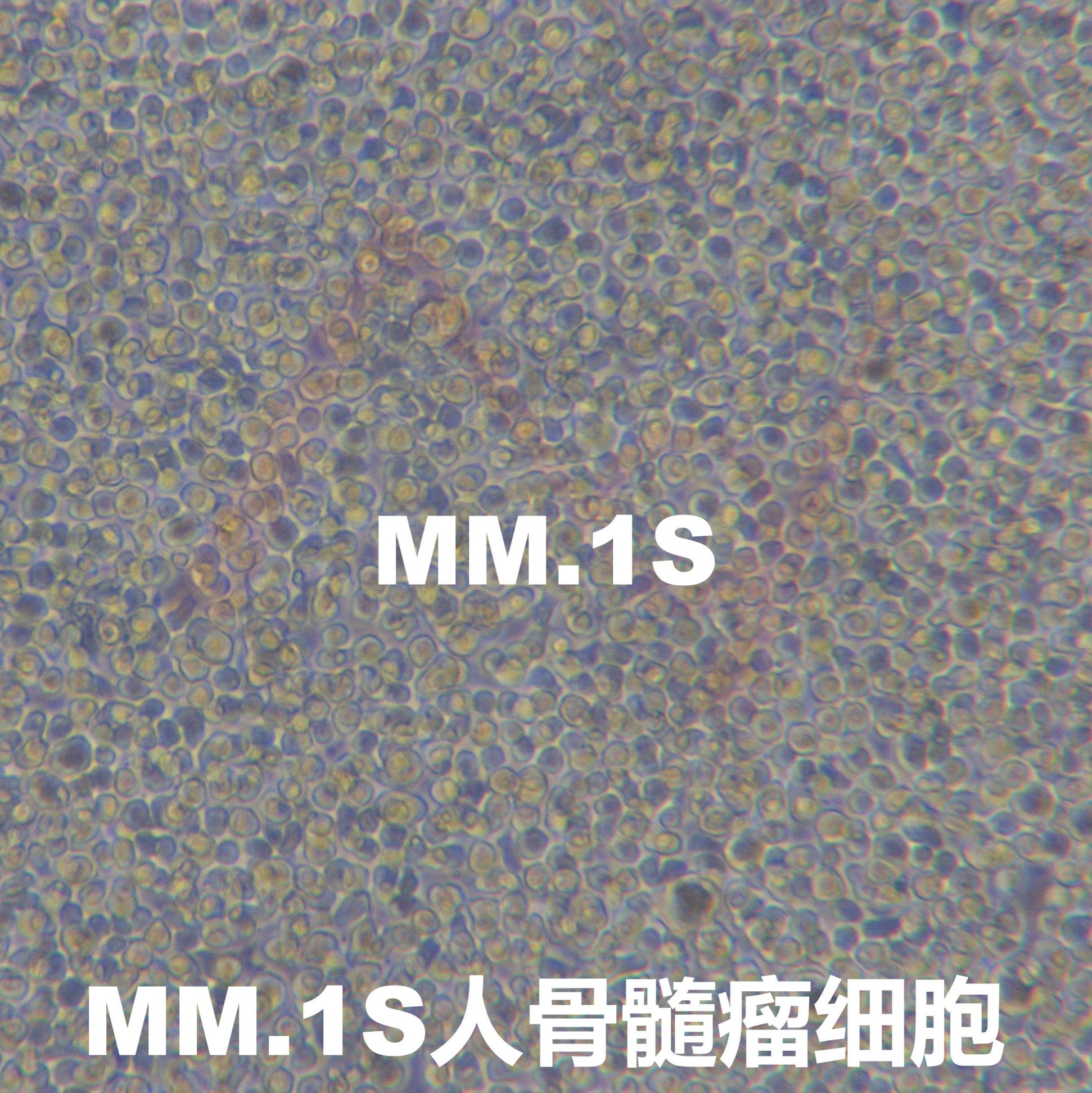 MM.1S[MM.1S; MM1-S; MM-1S; MM1S]人IgA-骨髓瘤细胞