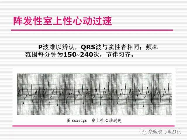 タープはEDを引き起こしますか？