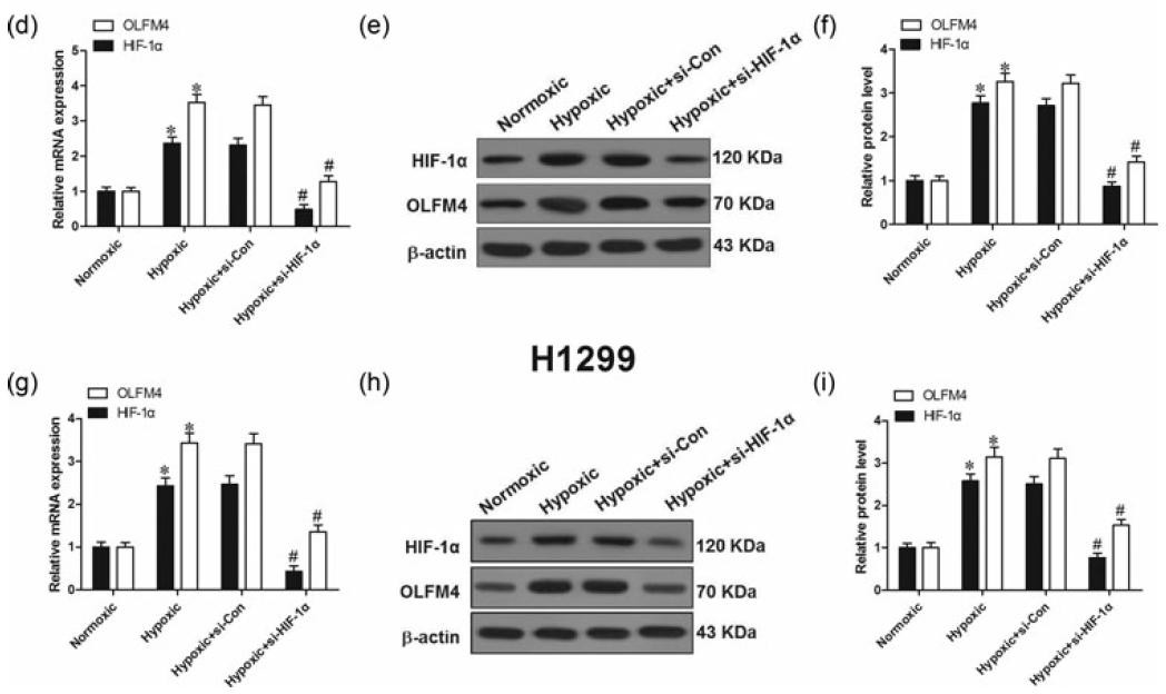 Ruskinn低氧工作站细胞领域研究——敲除 OLFM4/HIF1α减少非小细胞肺癌的低氧诱导损伤、化学耐药性和上皮细胞向间充质干细胞的转移