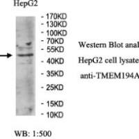 TMEM194A Antibody