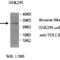 TOLLIP Antibody