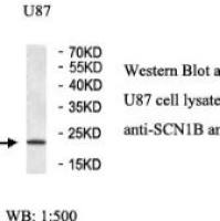 SCN1B Antibody
