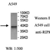 RIPK2 Antibody