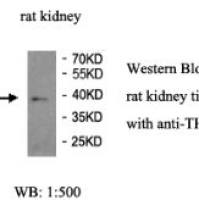 THOC6 Antibody
