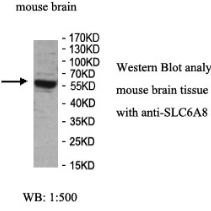 SLC6A8 Antibody