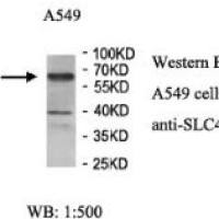 SLC40A1 Antibody