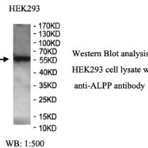 ALPP Antibody