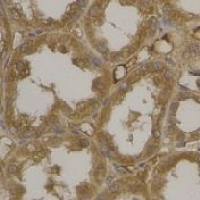 ZNF169 Antibody