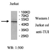 TUBB2A Antibody