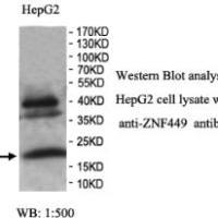 ZNF449 Antibody