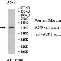 AUP1 Antibody