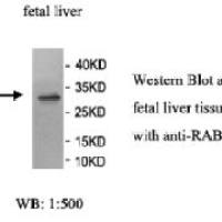 RAB34 Antibody