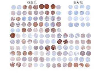 免疫组化(IHC)实验