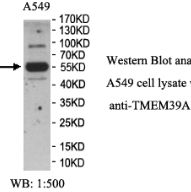 TMEM39A Antibody