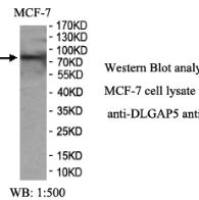 DLGAP5 Antibody