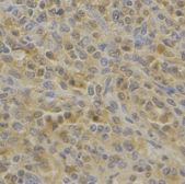 TMTC1 Antibody