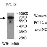 NCAPH2 Antibody