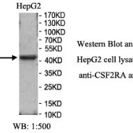 CSF2RA Antibody