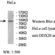 DDX20 Antibody
