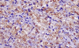 免疫组化(IHC)实验