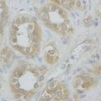 STXBP3 Antibody