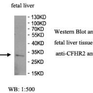 CFHR2 Antibody