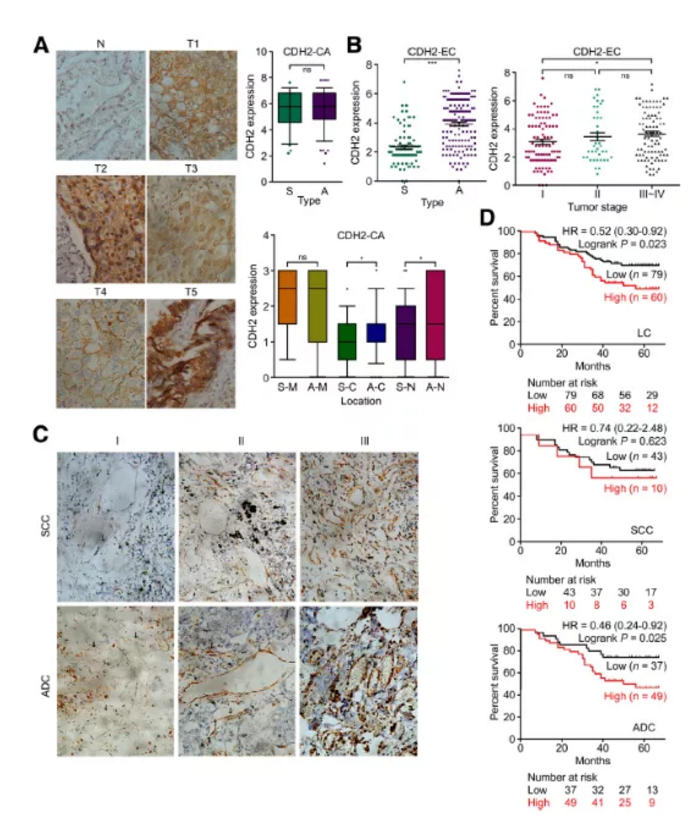 Molecular Cancer：蛋白质组学联合多种分子检测技术揭示CDH2以促进血管生成的方式促进肺腺癌的发生发展