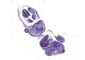 免疫组化(IHC)实验