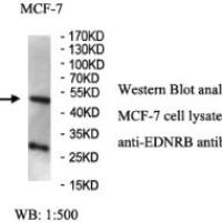 EDNRB Antibody