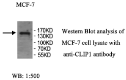 CLIP1 Antibody