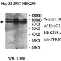 PFKM Antibody