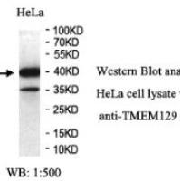 TMEM129 Antibody