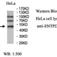 ENTPD5 Antibody