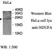 NDUFAF3 Antibody