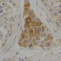 IFT43 Antibody