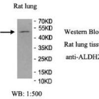 ALDH2 Antibody