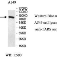 TARS Antibody
