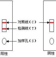人腮腺炎病毒酶联免疫法elisa抗体IgM酶免试剂盒