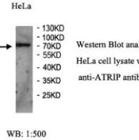 ATRIP Antibody