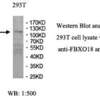 FBXO18 Antibody