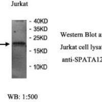 SPATA12 Antibody