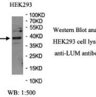 LUM Antibody
