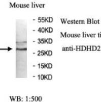 HDHD2 Antibody