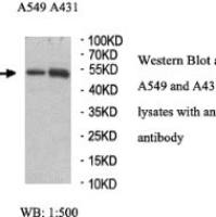 TGFBI Antibody