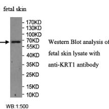 KRT1 Antibody