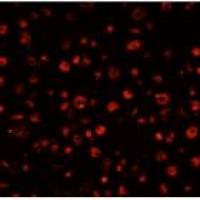 大鼠肝枯否Kupffer cell细胞