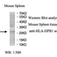 HLA-DPB1 Antibody