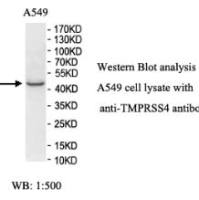 TMPRSS4 Antibody