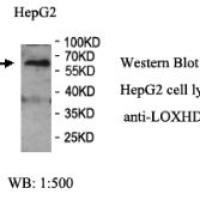 LOXHD1 Antibody